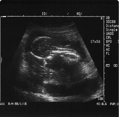 General Ultrasound Scan